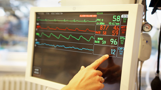 EKG Practice Test: Focused Review on Cardiac Rhythms
